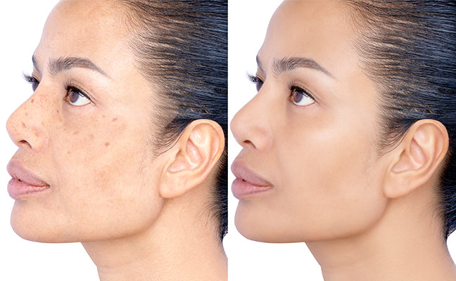 Retinol & Whitening 3-in-1 Micro Cream