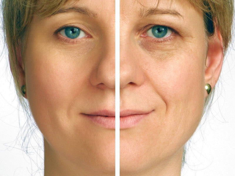 Retinol Anti-Aging Cream (20/30g)