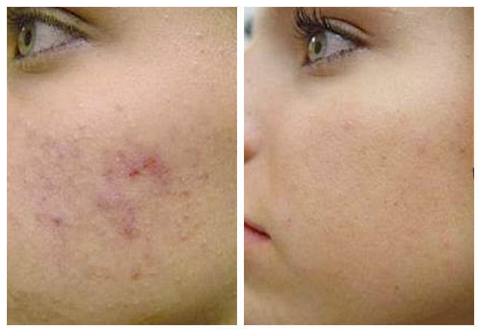 Retinol Anti-Aging Gel MICRO