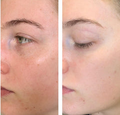 Whitening Cream